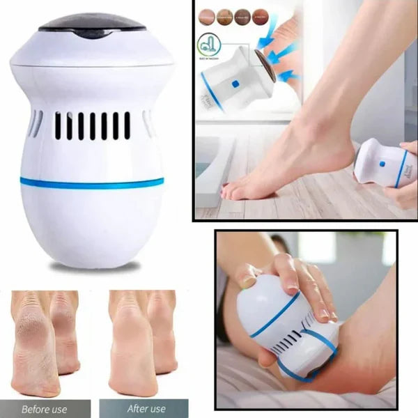 SmoothSole - Éliminateur De Calo Electronique Pour Pied