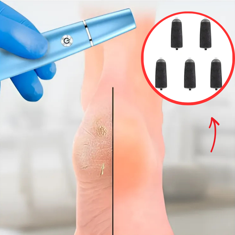 FileGrinder - Détachant De Callosités Meuleuse Pour Pieds Replacement Fichier