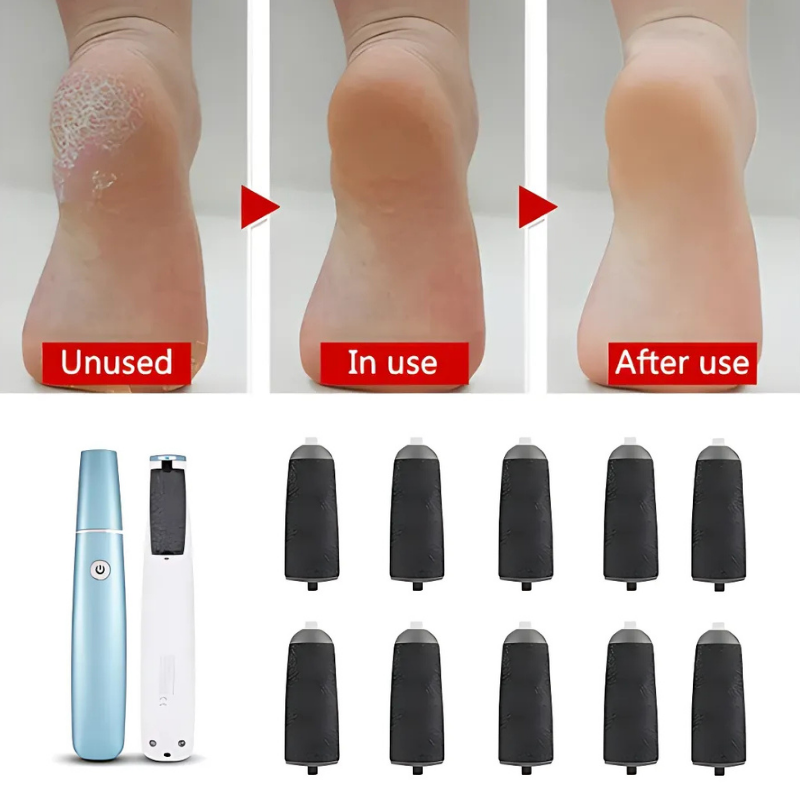 FileGrinder - Détachant De Callosités Meuleuse Pour Pieds Replacement Fichier