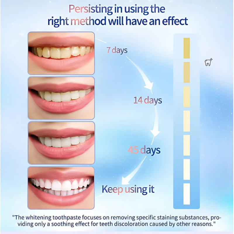 WhiteningToothpaste 1+1 GRATUIT : Dentifrice À La Niacinamide Blanchissant Et Détachant