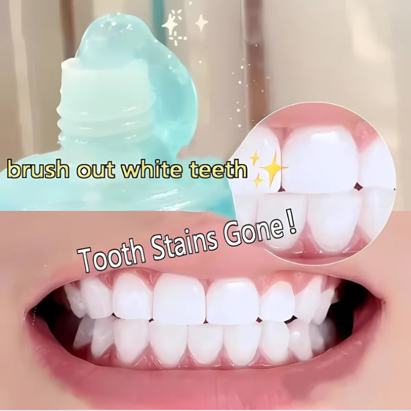 WhiteningToothpaste 1+1 GRATUIT : Dentifrice À La Niacinamide Blanchissant Et Détachant
