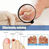 FungalPatch - Patch Antibactérien Et Antifongique Et Pack Soin Des Ongles