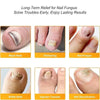 FungalPatch - Patch Antibactérien Et Antifongique Et Pack Soin Des Ongles