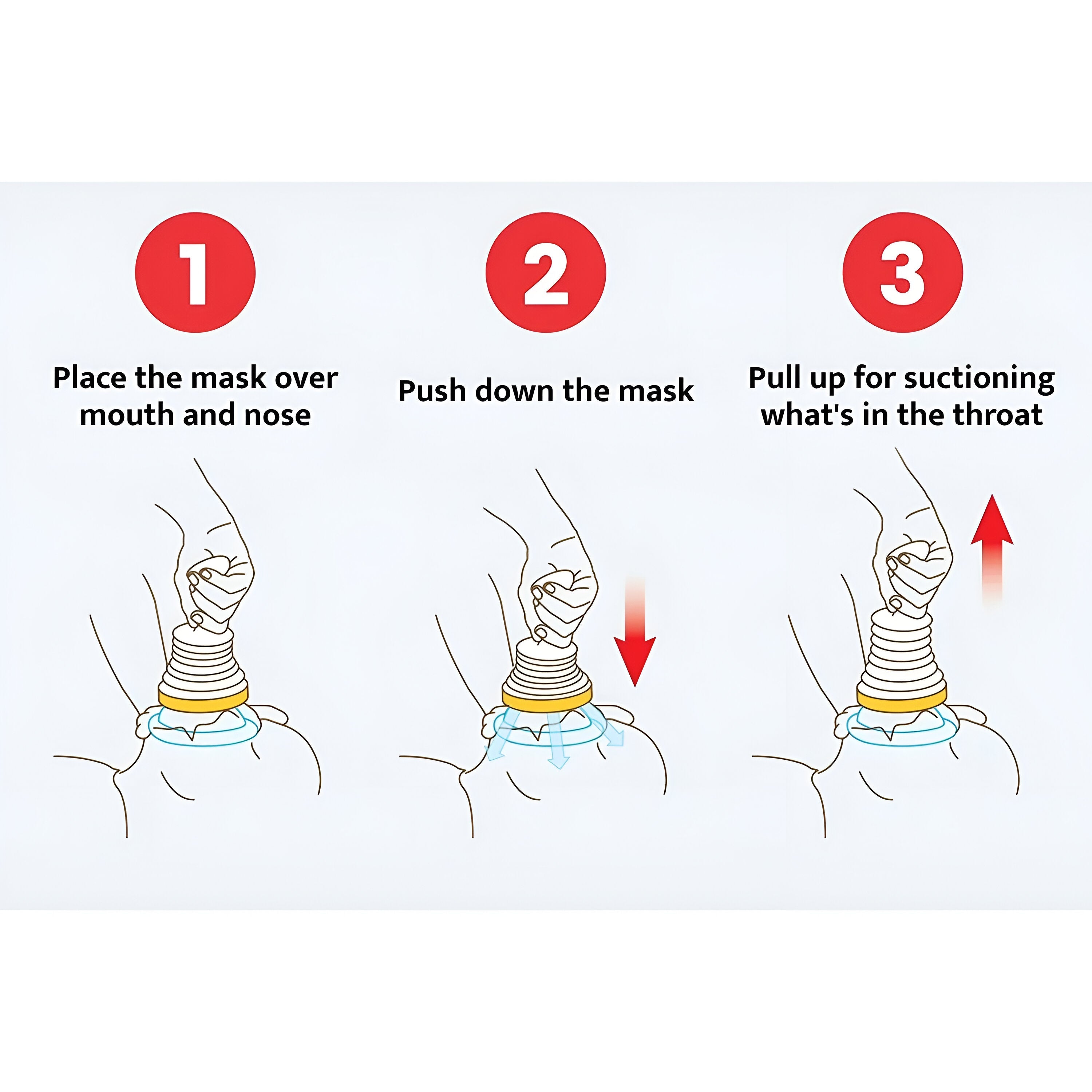 AirwayUnblocker - Réutilisable Urgence Voies Aériennes Débloqueur Appareil Kit