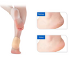 Happy™ HeelProtector 1+1 GRATUIT - Protège-Talon Souple en Silicone