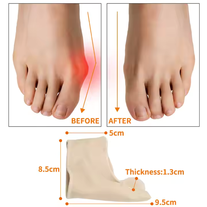 ToeCorrector : Correcteur D'Oignon Séparateur De Gros Orteil Coussin De Pied