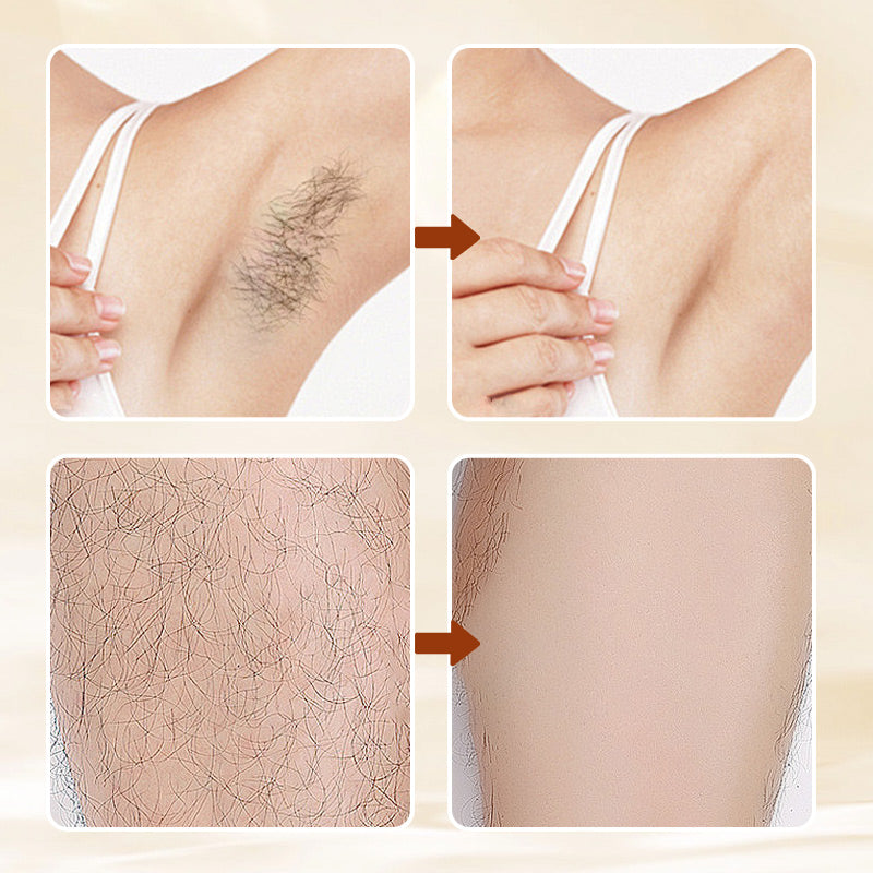 HairErase – Doux Cheveux Suppression Crème