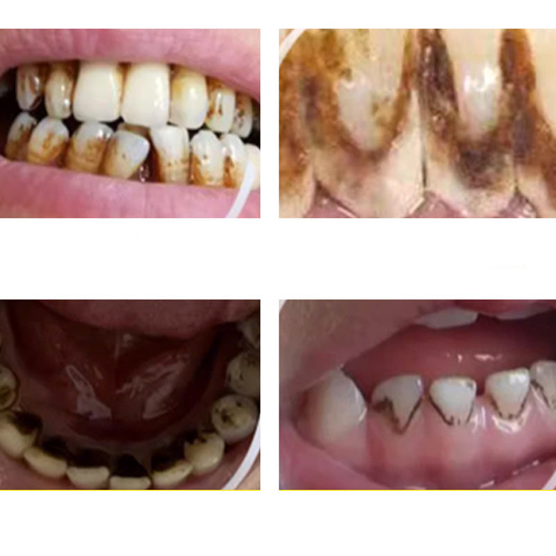 DentalCare – Kit D'Outils Faciles Pour Soins Dentaires À 360° À Domicile